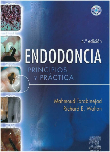 Endodoncia, Principios Y Práctica