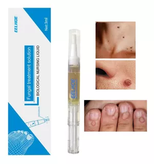 Elimina Verruga Papiloma Lunar Genital Rostro Cuerpo Pomada