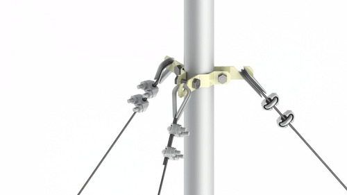 Kit Mástil Telescópico De 6 M C/ Accesorios De Instalacion