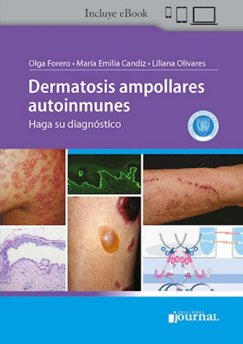 Dermatosis Ampollares Autoinmunes. Forero Candiz Olivares