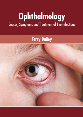 Libro Ophthalmology: Causes, Symptoms And Treatment Of Ey...