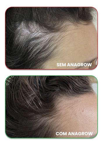 Vitamina D2, A E K2 Em Gotas - 30ml Sem Sabor