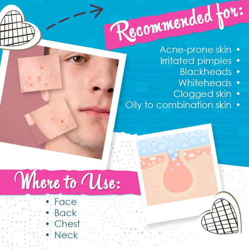 Loción Secante Para El Acné Bye Bye Bye Blemish Reduce Las E