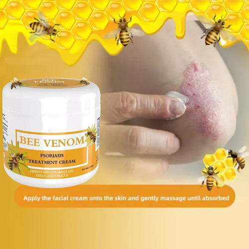 5×crema Para Tratamientos Psoriasis Con Venenos Abeja