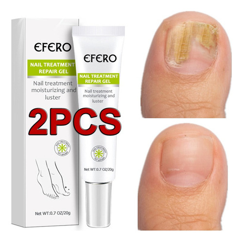 Efero 2 Unidades De Gel For Eliminación De Hongos En Las