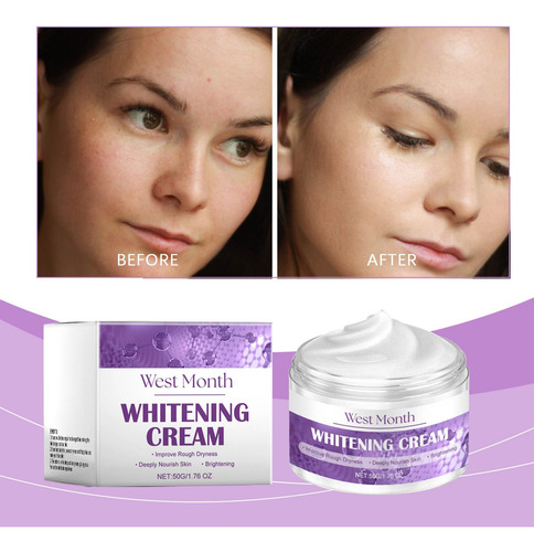 La Crema Facial Hidratante Y Polipeptídica Ayuda A Blanquear