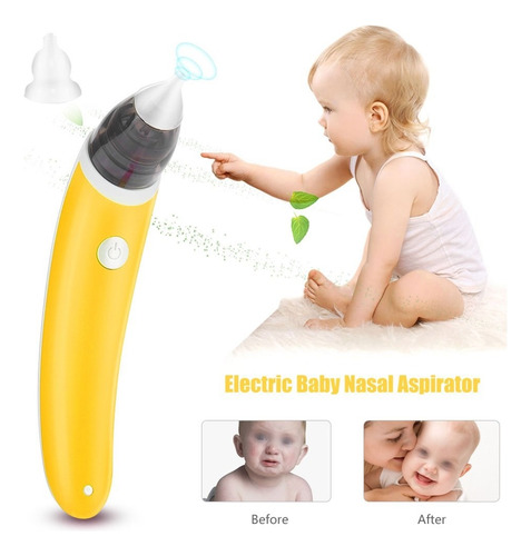 Imagen 6 de 8 de Aspirador Eléctrico Nasal Y Auditivo Seguro Para Bebes