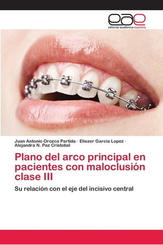 Libro: Plano Del Arco Principal Pacientes Con Maloclusión