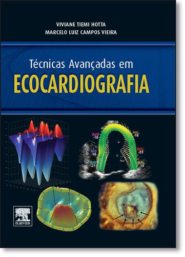 Técnicas Avançadas Em Ecocardiografia