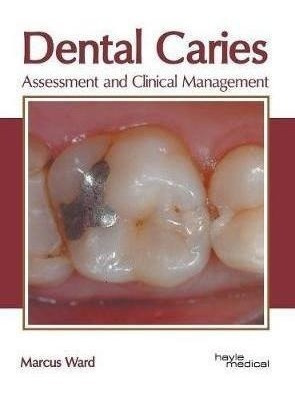 Dental Caries: Assessment And Clinical Management - Marcu...