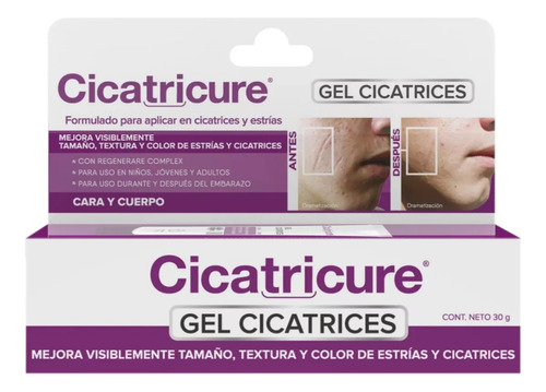 Cicatricure Gel Cicatrices, 30 Gm