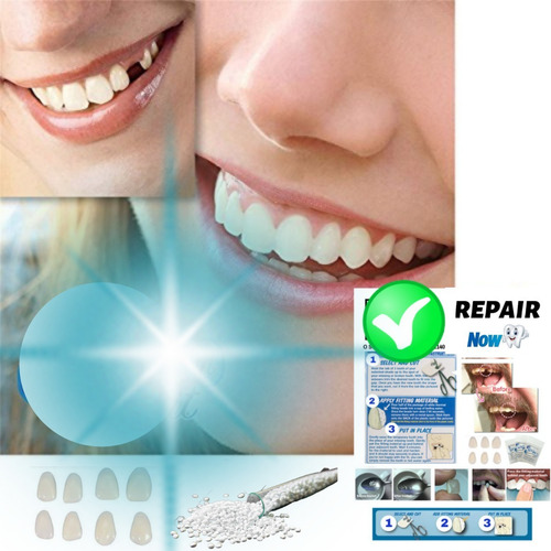 Imagen 5 de 6 de Kit Dentadura Provisoria Postiza Cosmética Agnovedades