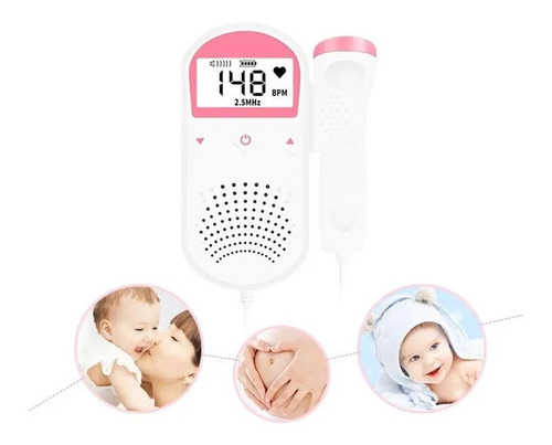 Ultrasonido Prenatal Latidos Corazón Bebe Envìo Inmediato