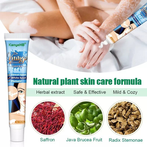 Crema China Para Tratar Vitiligo