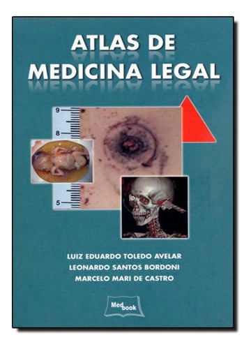 Livro Atlas De Medicina Legal , Defeito Na Capa - Avelar