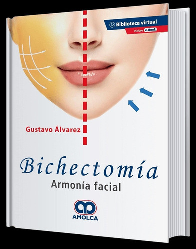 Bichectomía. Armonía Facial