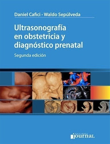 Libro - Ultrasonografía En Obstetricia Y Diagnóstico Prenata