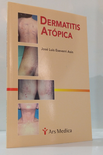  Libro De Dermatitis Atópica  José Luis Eseverri