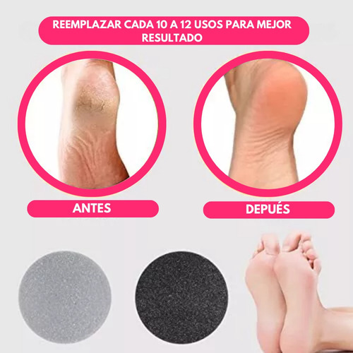 Pack De Repuestos Para Removedor De Callos Pedi Vac