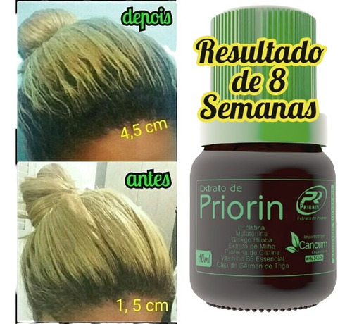 Cresce Cabelo Extrato De Priorin - Tônico Cresce Pelo