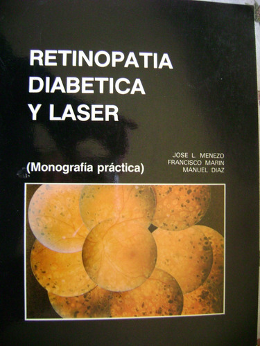 Retinopatia, Diabetica Y Laser.dr. Jose L Menezo