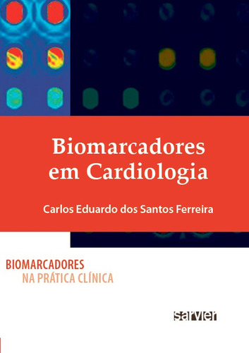 Biomarcadores em cardiologia, de Ferreira, Carlos Eduardo S.. Sarvier Editora de Livros Médicos Ltda, capa mole em português, 2012