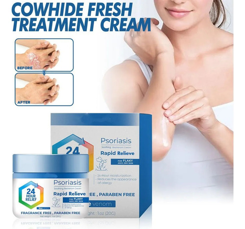 3. Solución Eficaz Para La Psoriasis Eccematoide Sin Tratami