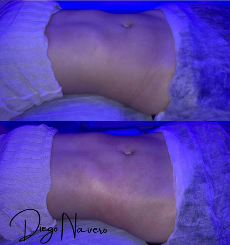 Imagem 1 de 4 de Massagens - Linfática, Massofilaxia, Modeladora.