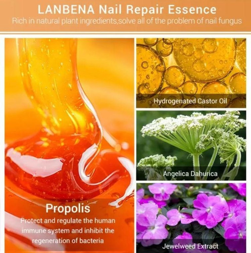 Tratamientos Para Hongos En Uñas 15 Ml Lanbena®
