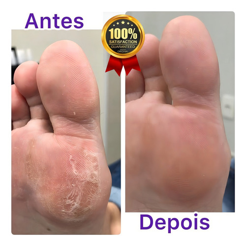 Creme Sebo De Carneiro 200g Anti Ressecamento E Rachaduras