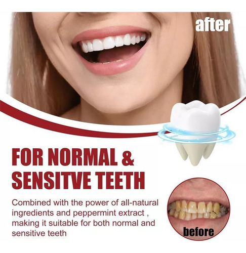 Mz Pasta De Dientes Sp-8 De 2 Piezas, Pasta De Dientes De