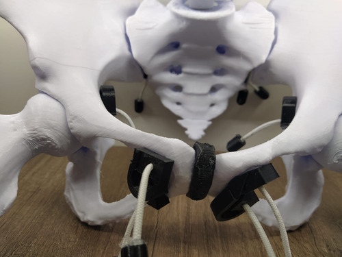 Pelvis Femenina Articulada Con Vertebra L4