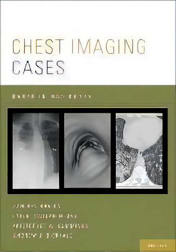 Chest Imaging Cases, De Sanjeev Bhalla. Editorial Oxford University Press Inc, Tapa Blanda En Inglés