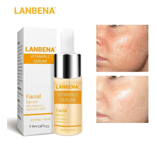 Serum Ácido Hialurónico Lanbena Original Facial Variedades
