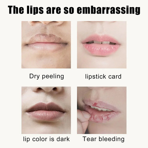 Gm Mascarilla Labial De Cristal De Cereza