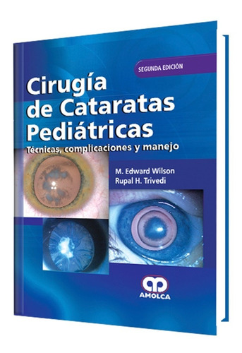 Cirugía De Cataratas Pediátricas. Técn Complicacion Y Manejo