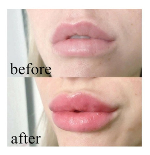 Imagen 5 de 7 de Lipgloss Balsamo Extracto Aloe Vera 99% Huxia Beauty