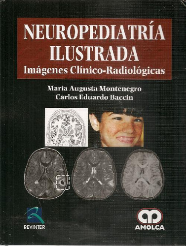 Libro Neuropediatría Ilustrada De María Augusta Montenegro C