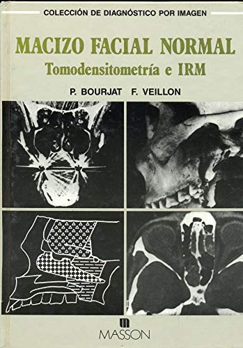 Libro Macizo Facial Normal Tomodensiometria E Irm De P Bourj