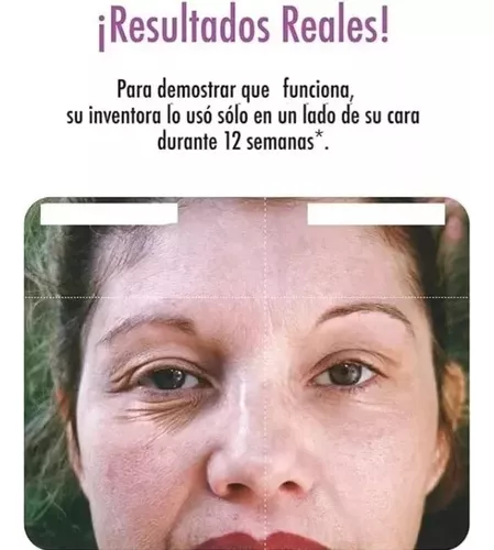GENERICO Rodillo Masajeador Facial Antiarruga Antiedad