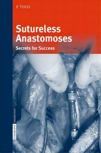 Sutureless Anastomoses : Secrets For Success, De Piergiorgio Tozzi. Editorial Steinkopff Darmstadt, Tapa Dura En Inglés
