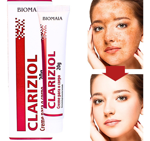 Melhor Clareador Para Melasma 2025 Clareador de Pele Melasma