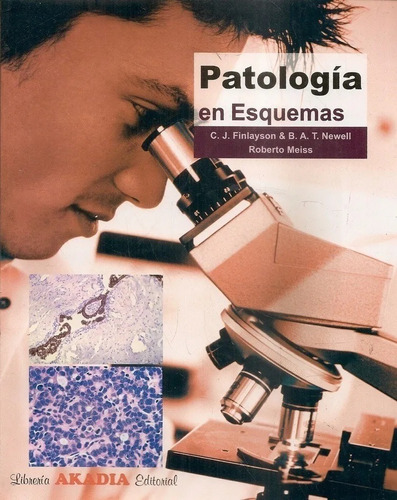 Patología En Esquemas Finlayson !