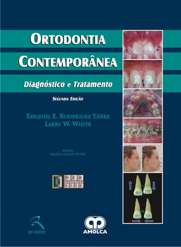 Ortodontia Contemporânea: Diagnóstico e Tratamento, de Yanez, Esequiel E. Rodríguez. Editora Thieme Revinter Publicações Ltda, capa dura em português, 2015