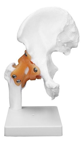 Imagen 1 de 7 de Modelo Articulación De Cadera