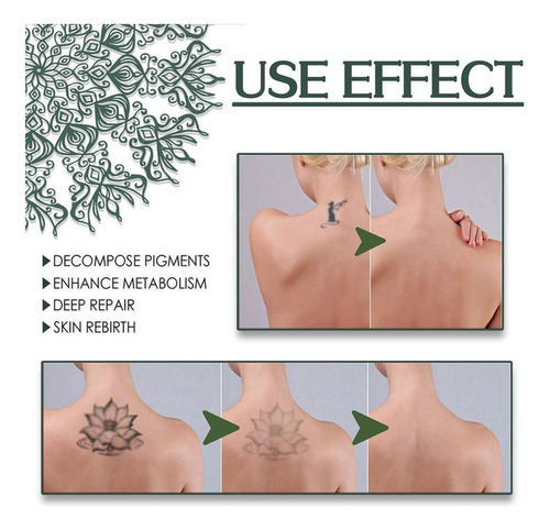 - Limpieza Rápida De La Crema De Eliminación De Tatuajes