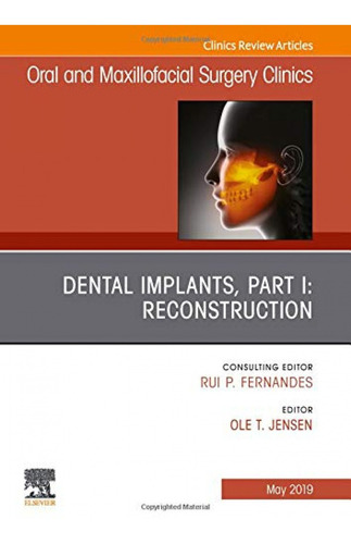 Dental Implants, Part I