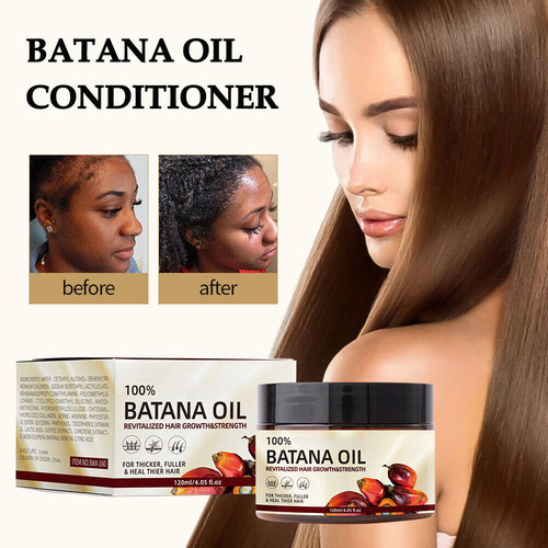 Mox Aceite Capilar Batana, Crecimiento Del Cabello, Pérdida