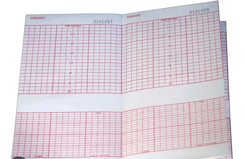 Papel Para Monitor Fetal Cadense, Biocare Fm 801