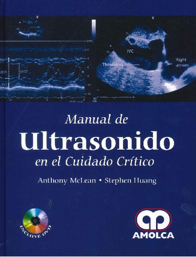 Libro Manual De Ultrasonido En El Cuidado Crítico De Anthony